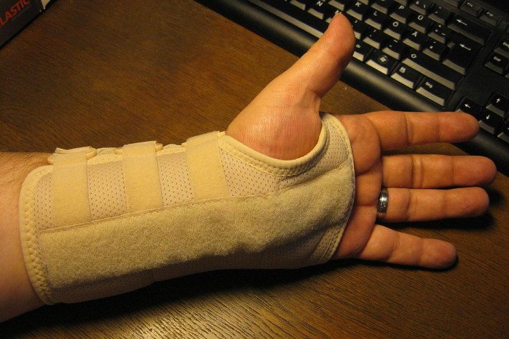 Carpal-Tunnel-Syndrome-and-its-effective-treatments