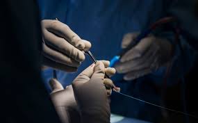 MICRODISCECTOMY-AN-EFFICIENT-SURGERY-PROCEDURE-FOR-HERNIATED-DISC